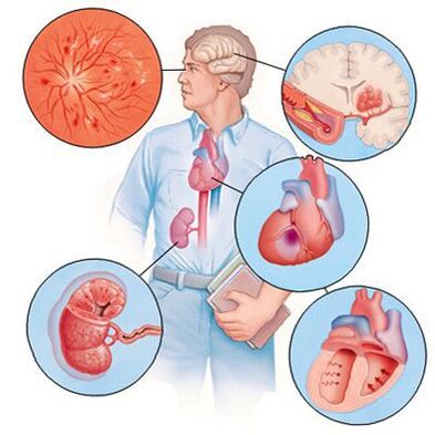 Cardiol previene el desarrollo de enfermedades concomitantes